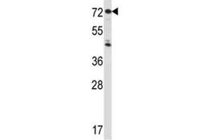 Image no. 3 for anti-Interleukin 1 Receptor, Type I (IL1R1) (AA 422-450) antibody (ABIN3031430)