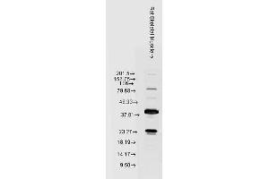 Image no. 2 for anti-Heat Shock 22kDa Protein 8 (HSPB8) antibody (PerCP) (ABIN2486745)