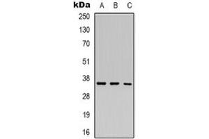 Image no. 1 for anti-Hairy/enhancer-of-Split Related with YRPW Motif 2 (HEY2) (Center) antibody (ABIN3071165)