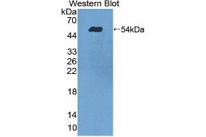 Image no. 1 for anti-Tyrosyl-DNA Phosphodiesterase 1 (TDP1) (AA 4-215) antibody (ABIN5014489)