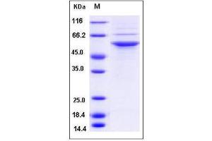 Image no. 1 for serine/threonine Kinase 24 (STK24) (AA 1-431) (Active) protein (His tag) (ABIN2005535)