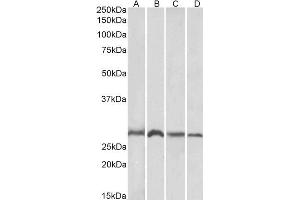 Image no. 3 for anti-E3 Ubiquitin-Protein Ligase SIAH1 (SIAH1) (N-Term) antibody (ABIN184675)