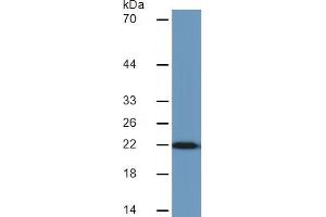 Image no. 4 for C-Reactive Protein (CRP) ELISA Kit (ABIN6730937)