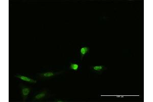 Image no. 4 for anti-Paraneoplastic Antigen MA2 (PNMA2) (AA 1-364) antibody (ABIN524136)