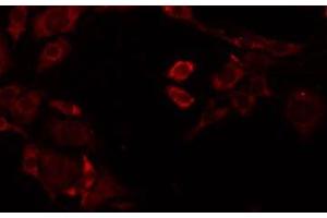 Image no. 1 for anti-Renin (REN) (Internal Region) antibody (ABIN6264697)
