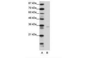 Image no. 1 for anti-Zinc Finger Protein 177 (ZNF177) (N-Term) antibody (ABIN6736158)