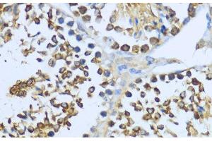 Immunohistochemistry of paraffin-embedded Mouse testis using HSP90AA1 Polyclonal Antibody at dilution of 1:200 (40x lens).