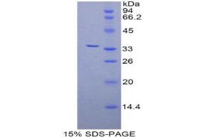 Image no. 1 for zeta-Chain (TCR) Associated Protein Kinase 70kDa (ZAP70) (AA 337-600) protein (His tag) (ABIN1877931)
