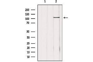 Image no. 3 for anti-Ubiquitin Specific Peptidase 11 (USP11) (Internal Region) antibody (ABIN6258345)