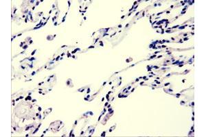 Image no. 3 for anti-V-Akt Murine Thymoma Viral Oncogene Homolog 3 (Protein Kinase B, Gamma) (AKT3) antibody (ABIN2715859)