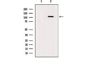 Image no. 3 for anti-Toll-Like Receptor 8 (TLR8) (C-Term) antibody (ABIN6265604)
