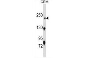 NHSL1 Antibody (Center) (ABIN1538546 and ABIN2849679) western blot analysis in CEM cell line lysates (35 μg/lane).