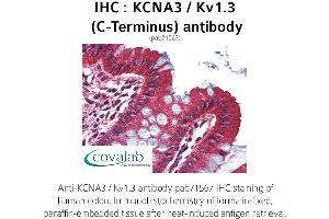 Image no. 1 for anti-Potassium Voltage-Gated Channel, Shaker-Related Subfamily, Member 3 (KCNA3) (C-Term) antibody (ABIN1736164)