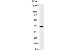 HSD17B2 Antikörper  (AA 373-387)