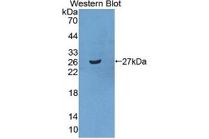 Image no. 2 for anti-Signal Recognition Particle Receptor, B Subunit (SRPRB) (AA 56-269) antibody (ABIN5014313)