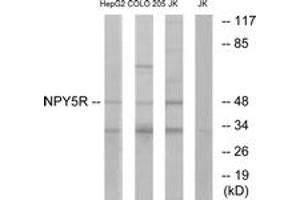 Image no. 1 for anti-Neuropeptide Y Receptor Y5 (NPY5R) (AA 221-270) antibody (ABIN1535790)