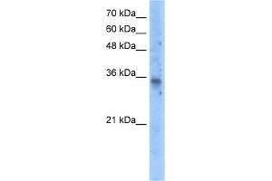 Image no. 1 for anti-Solute Carrier Family 25 (Mitochondrial Carrier, Graves Disease Autoantigen), Member 16 (SLC25A16) (N-Term) antibody (ABIN2781727)