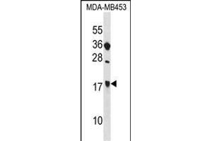SIT1 antibody  (C-Term)