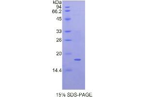 Image no. 1 for Quiescin Q6 Sulfhydryl Oxidase 1 (QSOX1) (AA 37-181) protein (His tag) (ABIN1878308)