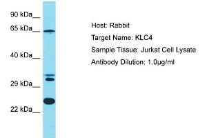 Image no. 1 for anti-Kinesin Light Chain 4 (KLC4) (N-Term) antibody (ABIN2791623)