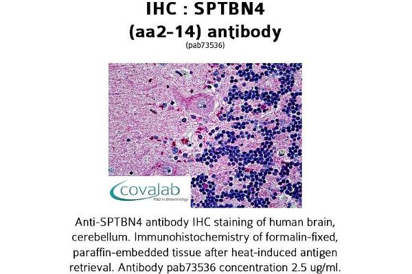 anti-Spectrin Beta, Non-Erythrocytic 4 (SPTBN4) (AA 2-14) antibody