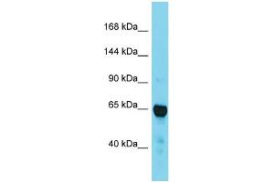 Image no. 1 for anti-Transforming, Acidic Coiled-Coil Containing Protein 2 (TACC2) (C-Term) antibody (ABIN2788943)