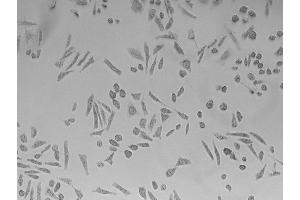 Image no. 2 for Pertussis Toxin (ARTC) (Active) protein (ABIN2452202)