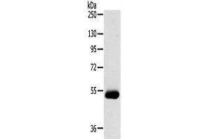Western blot analysis of Human breast infiltrative duct tissue using SERINC4 Polyclonal Antibody at dilution of 1:200