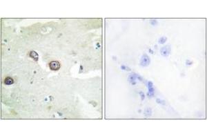 Image no. 1 for anti-Cadherin 4 (CDH4) (AA 731-780) antibody (ABIN1534296)