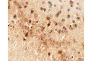 Image no. 1 for anti-Dorsal Inhibitory Axon Guidance Protein (DRAXIN) (C-Term) antibody (ABIN1450058)