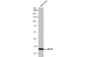 Image no. 2 for anti-2,4-Dienoyl CoA Reductase 1, Mitochondrial (DECR1) (full length) antibody (ABIN2856693)