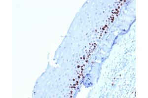 Image no. 6 for anti-Antigen Identified By Monoclonal Antibody Ki-67 (MKI67) (AA 2293-2478) antibody (ABIN6940053)