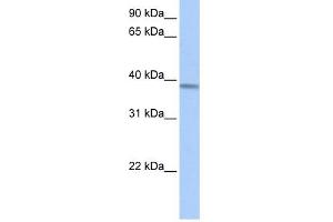 anti-Acyl-CoA Dehydrogenase, Short/branched Chain (ACADSB) (Middle Region) antibody