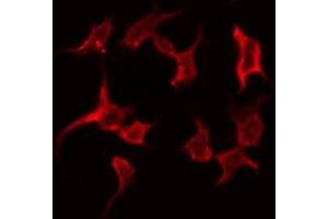 Gastrin antibody  (C-Term)
