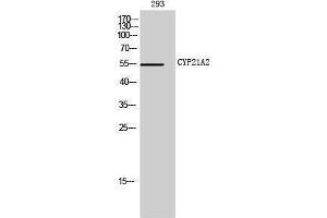 Image no. 1 for anti-Cytochrome P450, Family 21, Subfamily A, Polypeptide 2 (CYP21A2) (Internal Region) antibody (ABIN3184164)