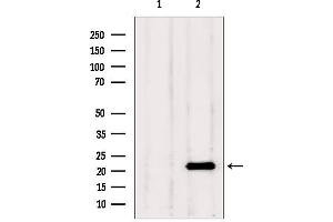 Image no. 1 for anti-Transgelin 2 (TAGLN2) (Internal Region) antibody (ABIN6265713)