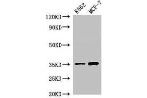 EN2 Antikörper  (AA 1-251)
