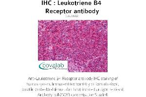 Image no. 1 for anti-Leukotriene B4 Receptor (LTB4R) (AA 331-352) antibody (ABIN1736424)