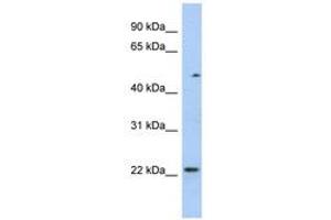 Image no. 1 for anti-Transcription Elongation Factor A (SII)-Like 3 (TCEAL3) (N-Term) antibody (ABIN6743568)