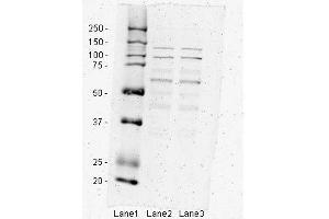 Image no. 4 for anti-Inhibitor of kappa Light Polypeptide Gene Enhancer in B-Cells, Kinase beta (IKBKB) (N-Term) antibody (ABIN2779787)