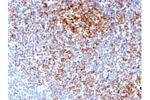 Image no. 3 for anti-B-Cell CLL/lymphoma 2 (BCL2) antibody (ABIN6940502)