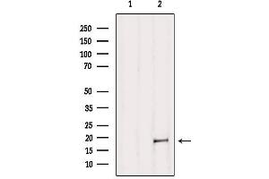 Image no. 1 for anti-MYC Associated Factor X (MAX) (N-Term) antibody (ABIN6263144)