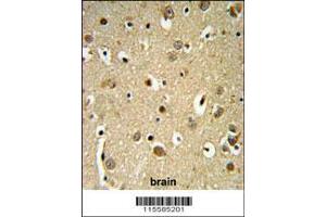 Image no. 2 for anti-Sprouty RTK Signaling Antagonist 4 (SPRY4) (AA 26-56) antibody (ABIN652338)