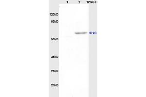 Pancreatic Amylase antibody  (AA 151-250)