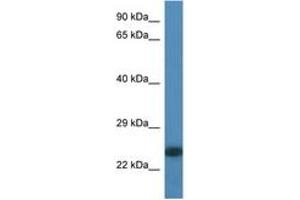 Image no. 1 for anti-Myosin, Light Chain 6B, Alkali, Smooth Muscle and Non-Muscle (MYL6B) (N-Term) antibody (ABIN6746337)