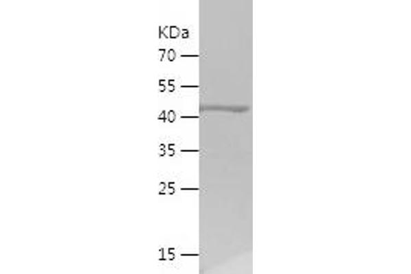 Tektin 3 Protein (TEKT3) (AA 278-490) (His-IF2DI Tag)