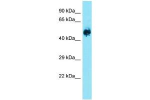 Image no. 1 for anti-Eukaryotic Translation Initiation Factor 2B, Subunit 3 Gamma, 58kDa (EIF2B3) (Middle Region) antibody (ABIN2790399)