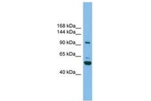 Image no. 1 for anti-SH3-Domain Binding Protein 4 (SH3BP4) (AA 71-120) antibody (ABIN6745080)