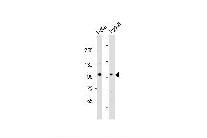Image no. 2 for anti-NOP2/Sun Domain Family, Member 2 (NSUN2) (AA 423-451) antibody (ABIN654767)