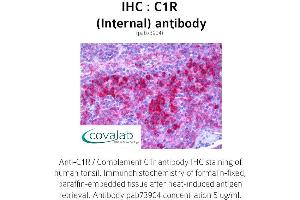 Image no. 1 for anti-Complement Component 1, R Subcomponent (C1R) (Internal Region) antibody (ABIN1732489)